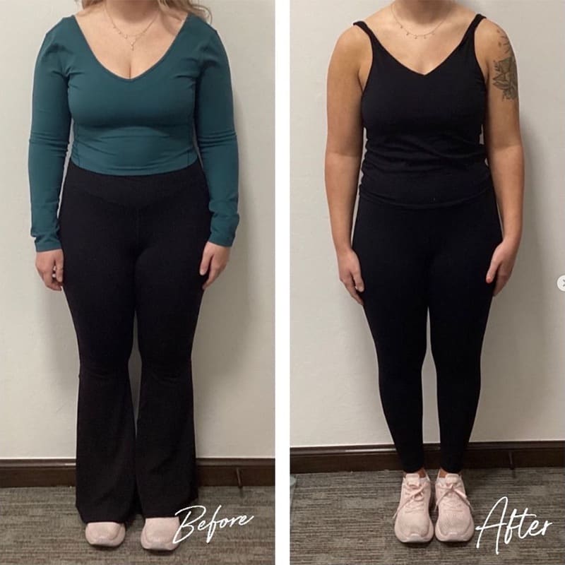 Medical Weight Loss Before & After Image