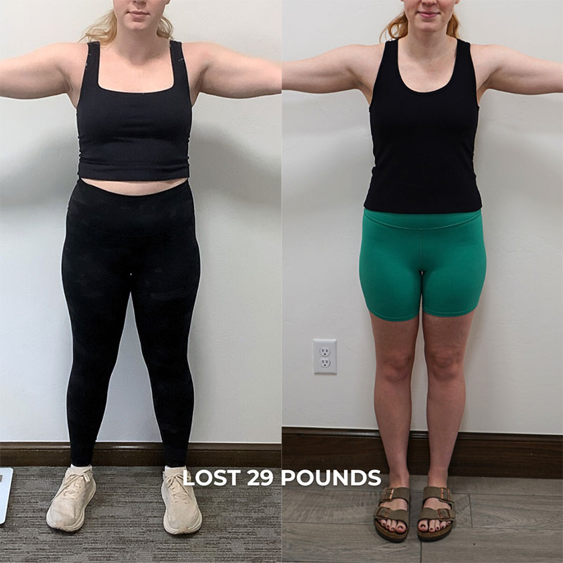 Medical Weight Loss Before & After Image