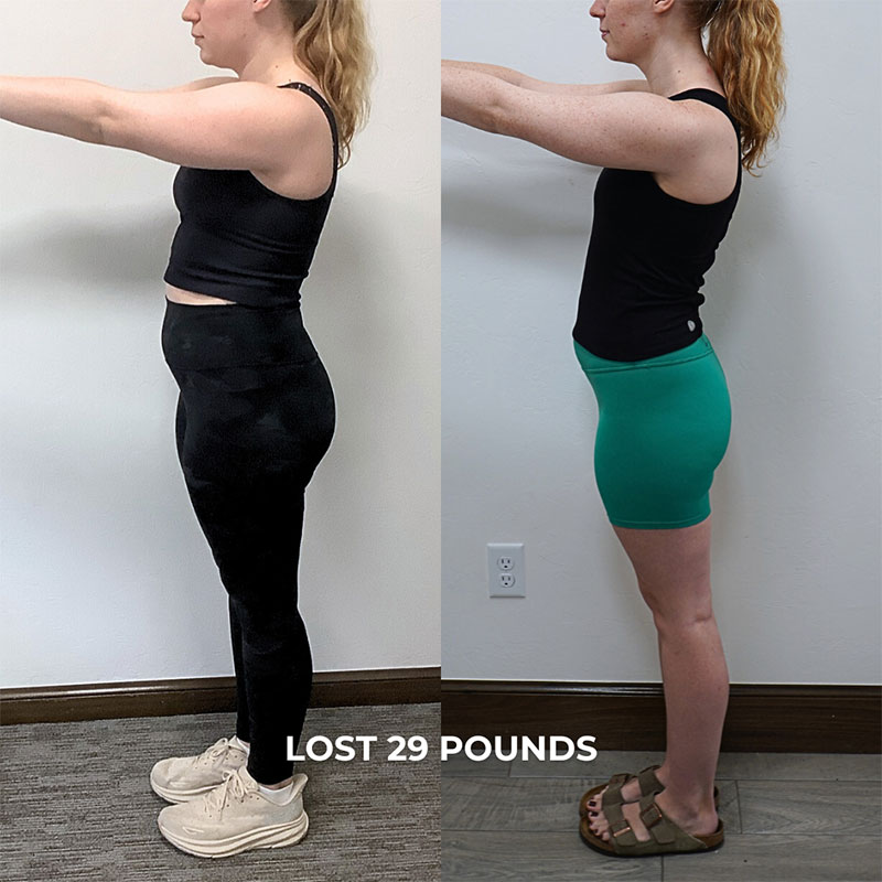 Medical Weight Loss Before & After Image