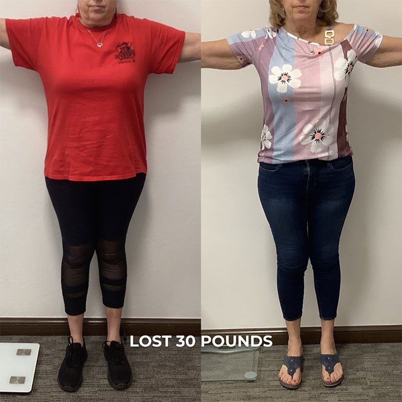 Medical Weight Loss Before & After Image